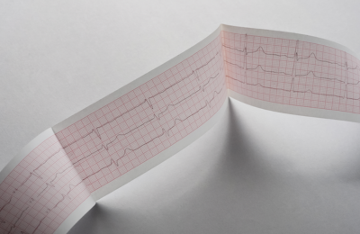 Функциональная диагностика в Екатеринбурге